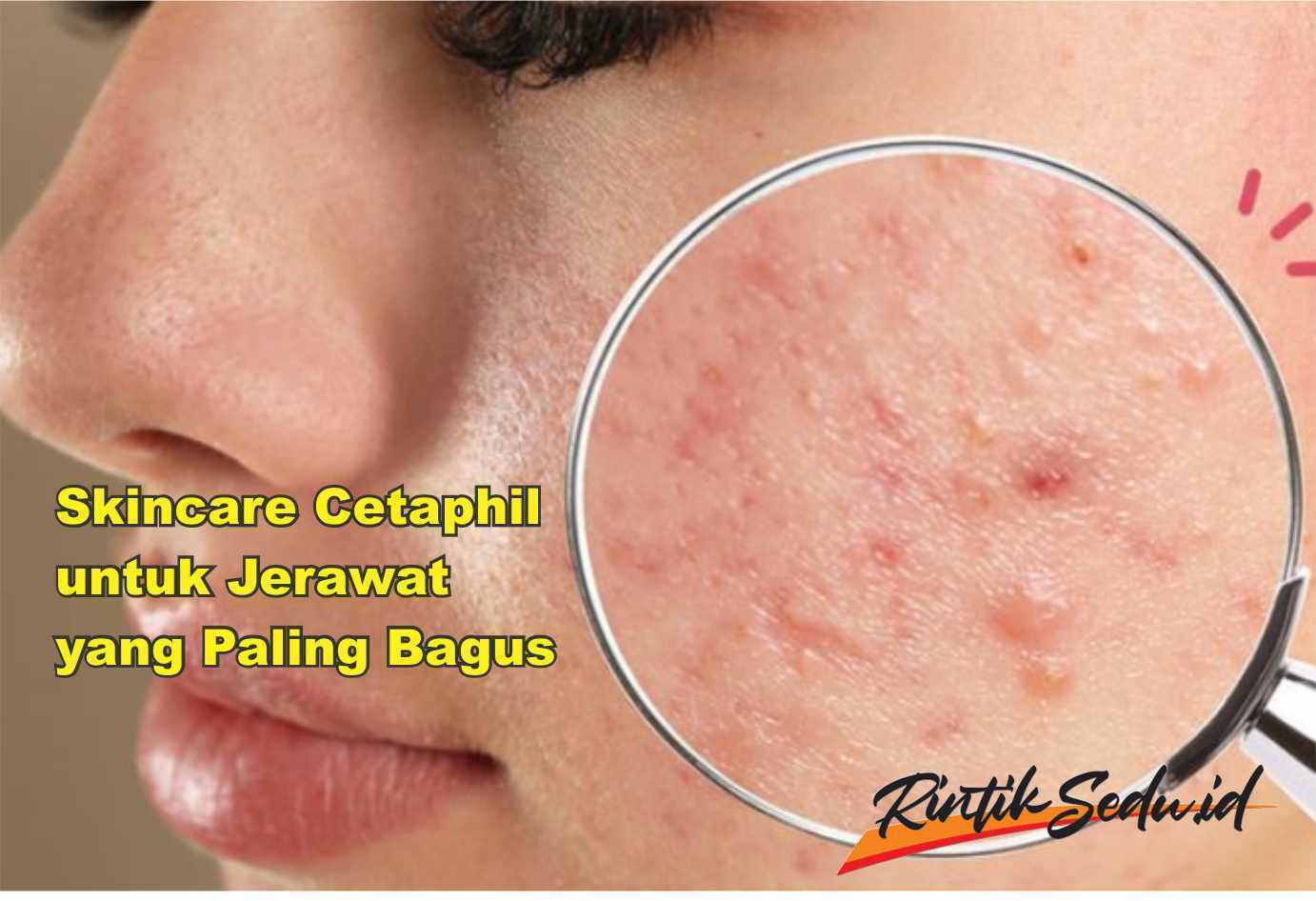 Cetaphil untuk Jerawat