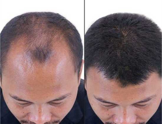 Shampo Penumbuh Rambut Terbaik