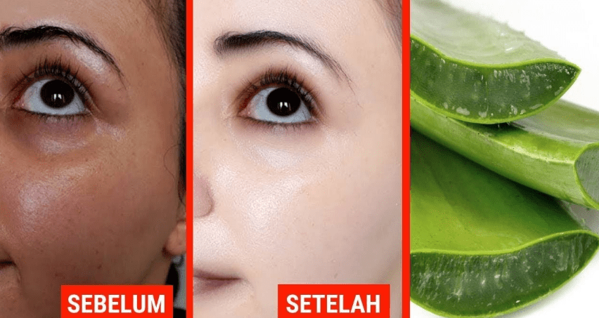 Manfaat Menggunakan Masker Lidah Buaya