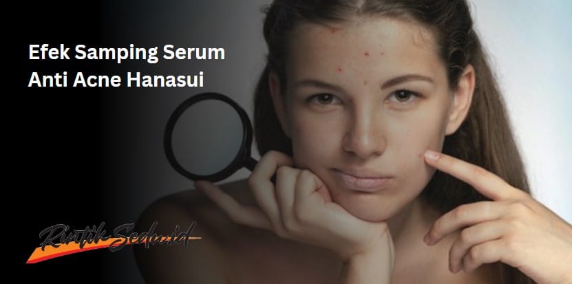 efek samping serum anti acne hanasui