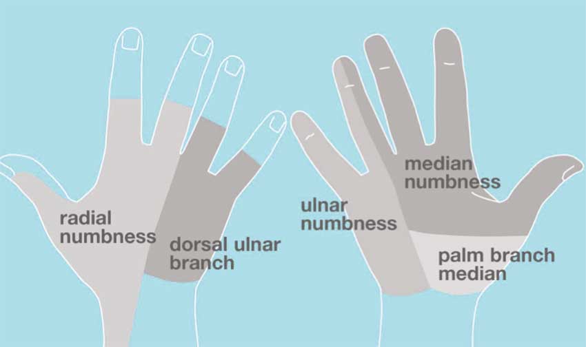 kesemutan di jari tangan
